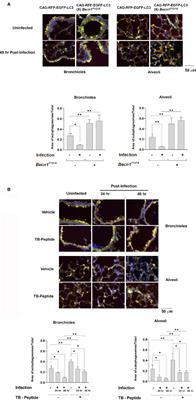 Beclin-1–Dependent Autophagy Improves Outcomes of Pneumonia-Induced Sepsis